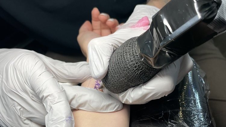 Gloved hands holding a wrapped tattoo machine over a client's forearm, a purple stencil line on the skin